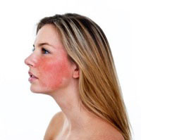 PER LA ROSACEA UN TRATTAMENTO COSMETICO SPECIFICO ANTIROSSORE